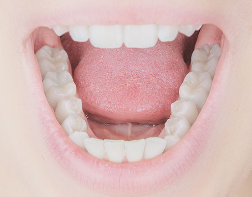 composite-fillings-e1600128530270